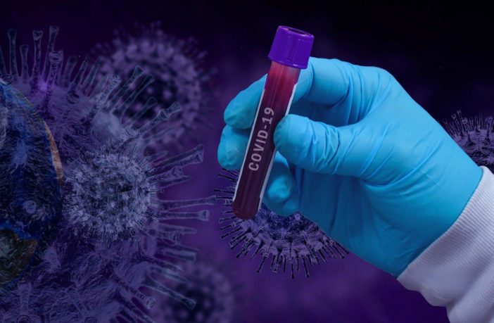 Covid. “Il virus da sé fuggito…” e l’informazione scientifica manipolata